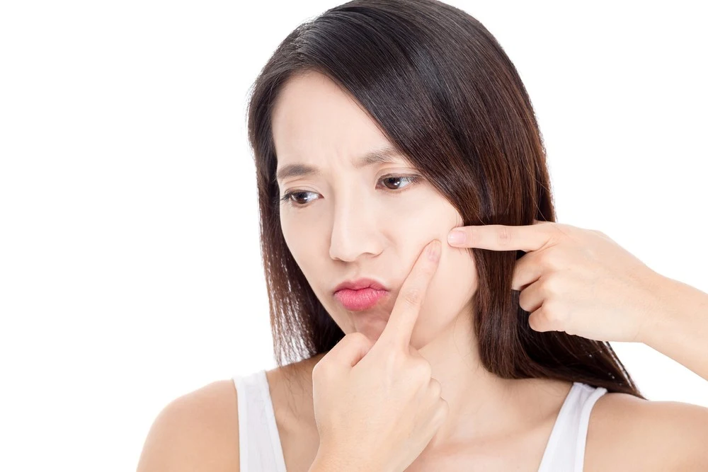 Acne is a red signal of skin and health problems