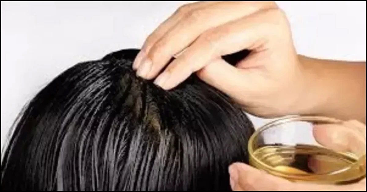 Castor oil
