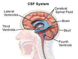 Diagram showing cerebrospinal fluid around the brain and ventricles.