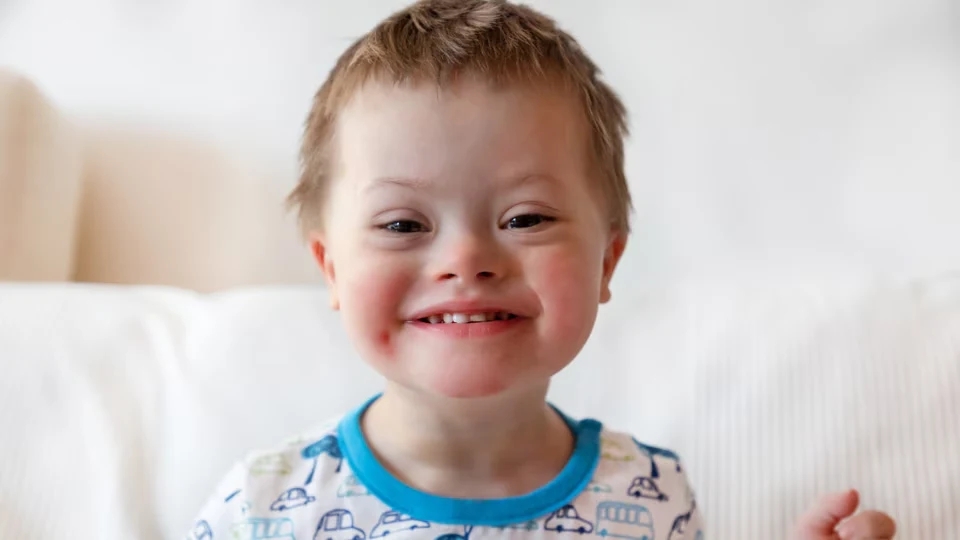 down's syndrome