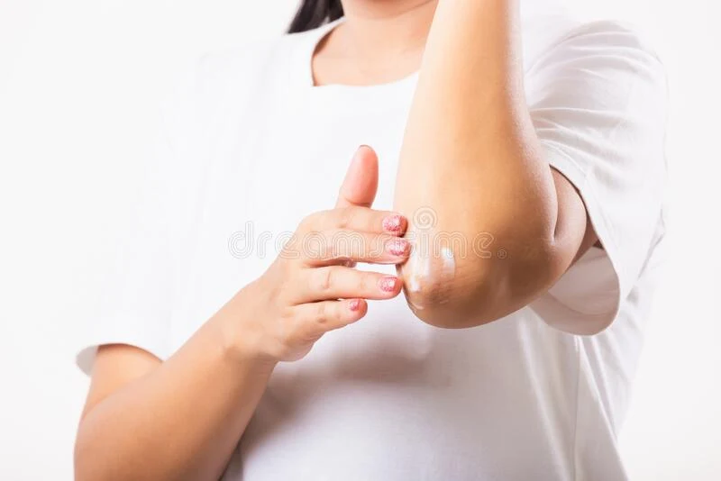 elbows and knees