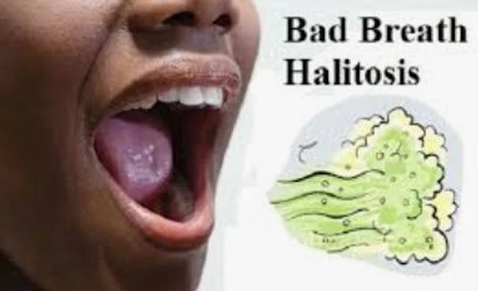 bad breath halitosis