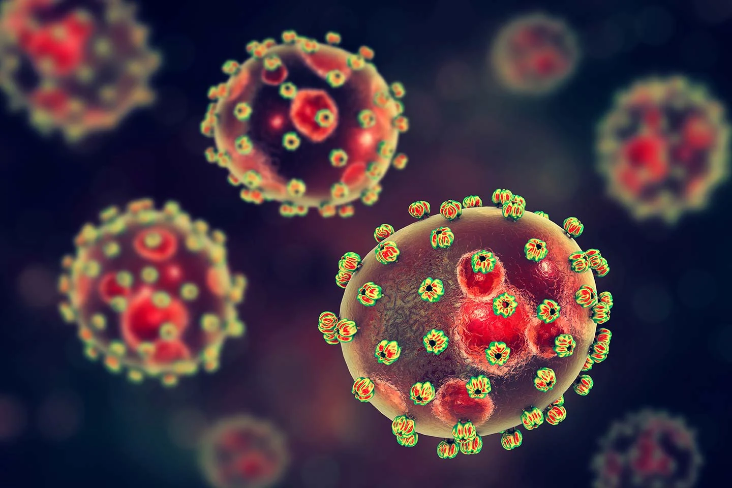 Lassa fever in Nigeria