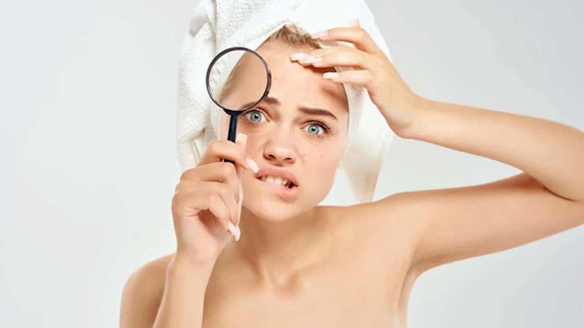 How to get rid of nail acne in rainy season