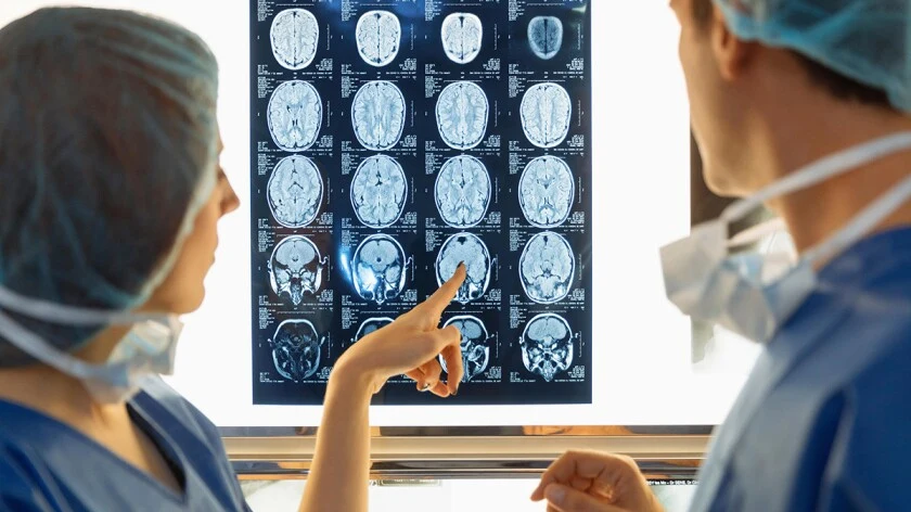 Medical professionals reviewing brain scan images on an illuminated display