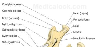 Fracture of the lower jaw bone ParT (II) Fracture of the lower jaw bone