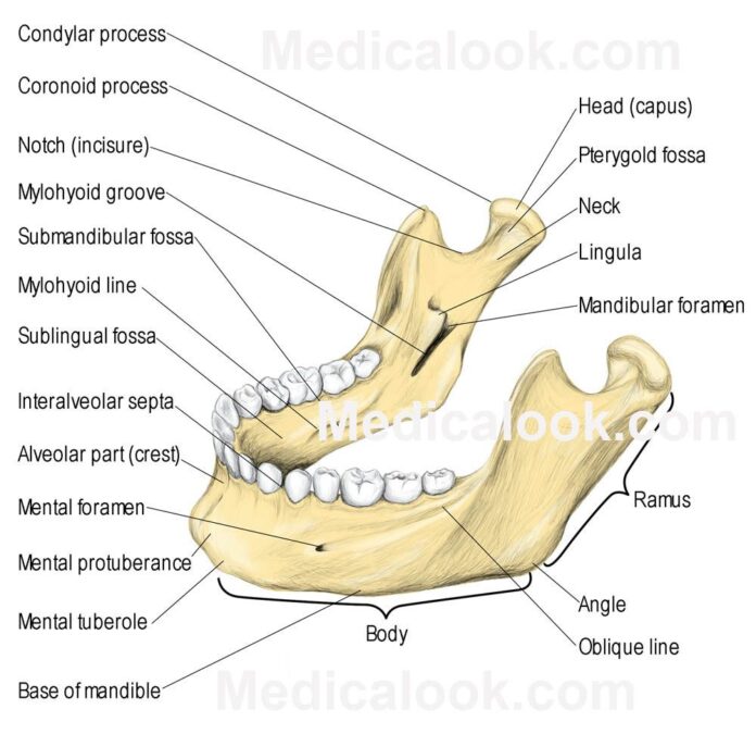 Fracture of the lower jaw bone