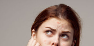 Acne is a red signal of skin and health problems ParT (II) Acne is a red signal of skin and health problems