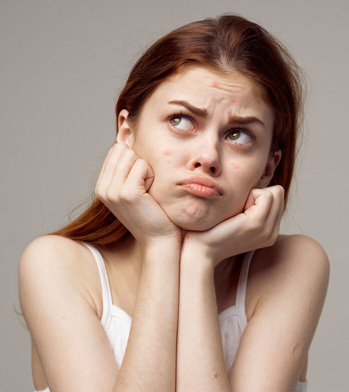 Acne is a red signal of skin and health problems