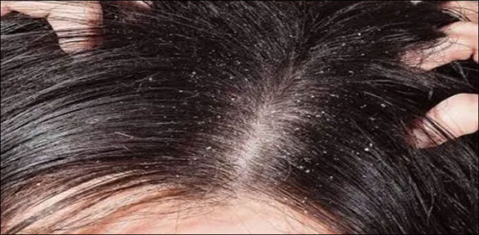 There will be no drought.