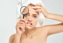 How to get rid of nail acne in rainy season How to get rid of nail acne in rainy season