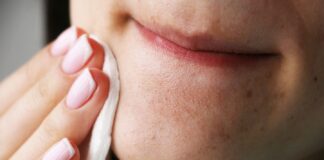 Blackheads: blackheads