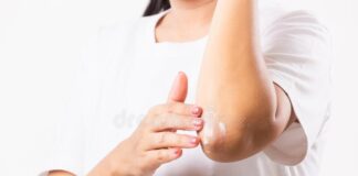 Get rid of dead skin on elbows and knees: elbows and knees
