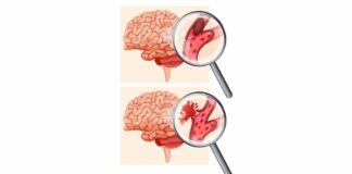 4 Magical Foods 4 Magical Foods That Can Prevent Blood Clotting