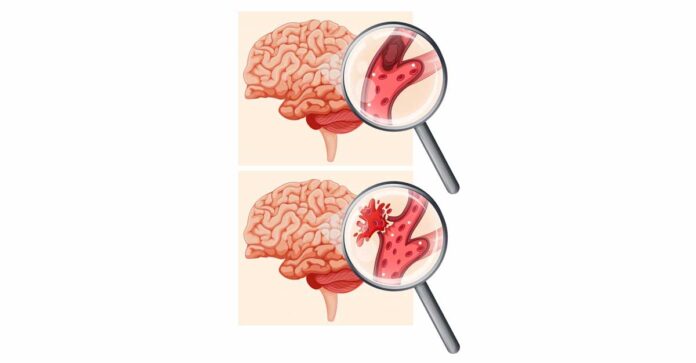 4 Magical Foods That Can Prevent Blood Clotting