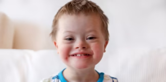 Down’s Syndrome down's syndrome