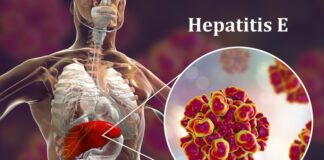 Discovering Hepatitis E E