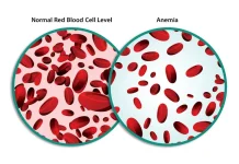 Anemia: A Common Blood Disorder Anemia: Causes and Symptoms