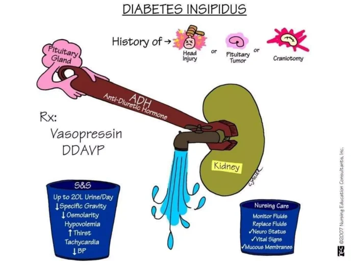 Diabetes Insipidus: Understanding the Rare Water Balance Disorder