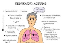 Respiratory Acidosis: Causes, Symptoms, and Treatment Respiratory Acidosis: Causes, Symptoms, and Treatment