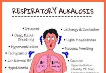 Respiratory Alkalosis: Causes, Symptoms, and Treatment Respiratory Alkalosis: Causes, Symptoms, and Treatment